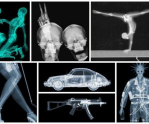 Мир в рентгеновских лучах — вид искусства, где видна изнанка бытия